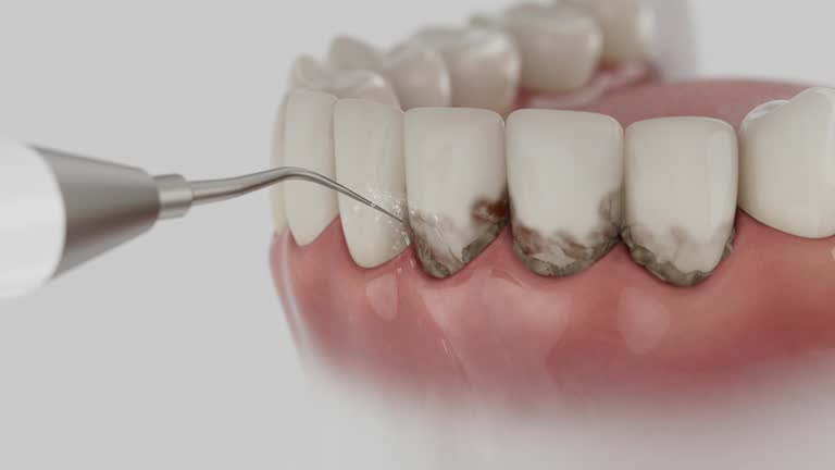 Trusted Teeth Cleaning And Checkup service in DeWitt, MI - Dentist Open Now